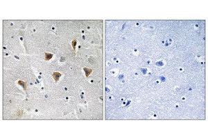 Immunohistochemistry (IHC) image for anti-Mitochondrial Transcription Termination Factor (MTERF) (Internal Region) antibody (ABIN1852304)