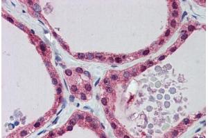 Human Thyroid: Formalin-Fixed, Paraffin-Embedded (FFPE) (PGK1 antibody  (AA 102-151))
