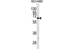 Western Blotting (WB) image for anti-Keratin 9 (KRT9) antibody (ABIN5023183) (KRT9 antibody)