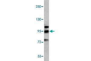 Western blot analysis of K-562 cell lysate (35 ug/lane) with GRM6 polyclonal antibody . (Metabotropic Glutamate Receptor 6 antibody  (C-Term))