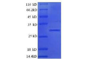 SDS-PAGE (SDS) image for Kallikrein B, Plasma (Fletcher Factor) 1 (KLKB1) (AA 391-638), (Light Chain) protein (His tag) (ABIN5713586) (KLKB1 Protein (AA 391-638, Light Chain) (His tag))