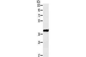 Western Blotting (WB) image for anti-Ornithine Carbamoyltransferase (OTC) antibody (ABIN2430591)