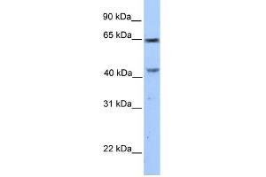 WB Suggested Anti-CCDC60 Antibody Titration: 0. (CCDC60 antibody  (C-Term))