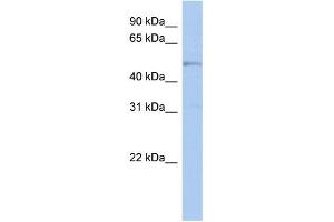 WB Suggested Anti-TBC1D10C Antibody Titration: 0. (Carabin antibody  (N-Term))