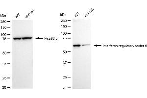 Western blotting analysis using interferon regulatory factor 6 antibody (ABIN7799087).