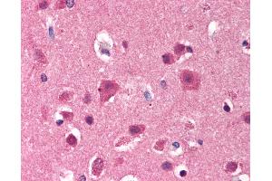 Anti-FYN antibody IHC of human brain, cortex.