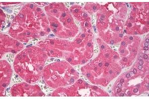 Image no. 2 for anti-Superoxide Dismutase antibody (ABIN1496240) (Superoxide Dismutase antibody)