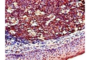 Immunohistochemistry of paraffin-embedded human tonsil tissue using ABIN7161085 at dilution of 1:100 (CD94 antibody  (AA 42-168))