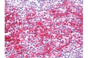 Anti-CD40 antibody IHC staining of human tonsil. (CD40 antibody)