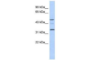 Cyclin Y-Like 1 antibody used at 1 ug/ml to detect target protein. (CCNYL1 antibody  (N-Term))
