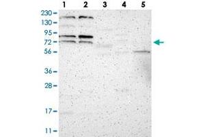 Western blot analysis of Lane 1: RT-4, Lane 2: U-251 MG, Lane 3: Human Plasma, Lane 4: Liver, Lane 5: Tonsil with ZNF90 polyclonal antibody . (ZNF90 antibody)