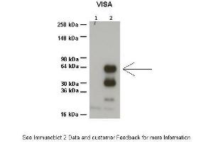 Sample Type :  1: 20ug HEK293T no transfection, 2: 20ug HEK293T 3Flag-MAVS/VISA  Primary Antibody Dilution :  1:1000  Secondary Antibody :  Anti-rabbit HRP  Secondary Antibody Dilution :  1:1000  Color/Signal Descriptions :  ARP49558-QC17479-WB-image-02  Gene Name :  VISA  Submitted by :  Dr. (MAVS antibody  (N-Term))