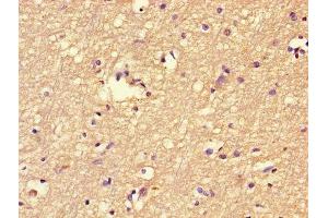 Immunohistochemistry of paraffin-embedded human brain tissue using ABIN7152464 at dilution of 1:100 (FBXL18 antibody  (AA 1-365))