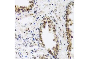 Immunohistochemistry of paraffin-embedded human prostate using SAFB2 antibody. (SAFB2 antibody)