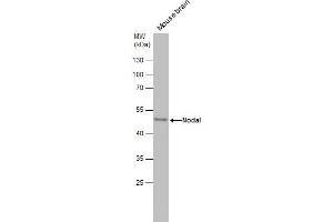 WB Image Mouse tissue extract (50 μg) was separated by 10% SDS-PAGE, and the membrane was blotted with Nodal antibody , diluted at 1:500. (Nodal antibody  (Center))