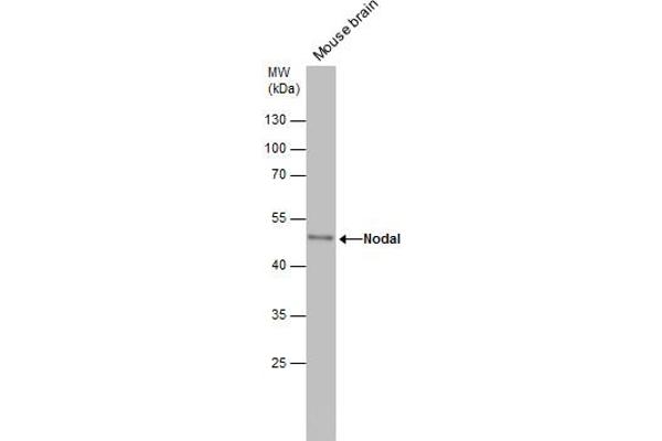 Nodal antibody  (Center)