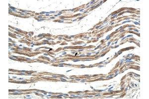 Pannexin 2 antibody was used for immunohistochemistry at a concentration of 4-8 ug/ml to stain Skeletal muscle cells (arrows) in Human Muscle. (Pannexin 2 antibody  (N-Term))