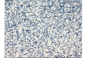 Immunohistochemical staining of paraffin-embedded colon tissue using anti-LTA4Hmouse monoclonal antibody. (LTA4H antibody)