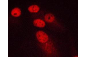 ABIN6266578 staining MCF-7 cells by ICC/IF. (Ki-67 antibody  (Internal Region))