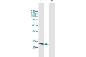 Western Blot analysis of RAB38 expression in transfected 293T cell line by RAB38 MaxPab polyclonal antibody. (RAB38 antibody  (AA 1-211))