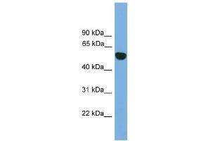 WB Suggested Anti-EPHX1 Antibody Titration: 0. (EPHX1 antibody  (N-Term))