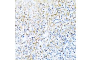 Immunohistochemistry (IHC) image for anti-NADH Dehydrogenase (Ubiquinone) 1 alpha Subcomplex, 5, 13kDa (NDUFA5) (AA 1-116) antibody (ABIN7268804)