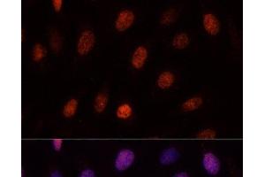 Immunofluorescence analysis of U-2OS cells using PCGF1 Polyclonal Antibody at dilution of 1:100. (PCGF1 antibody)