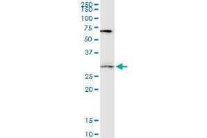 DKK1 monoclonal antibody (M06), clone 4C10. (DKK1 antibody  (AA 81-180))