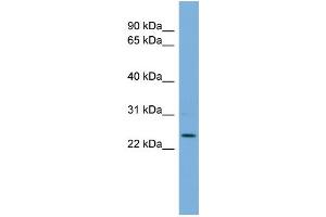 WB Suggested Anti-THAP6 Antibody Titration: 0. (THAP6 antibody  (Middle Region))