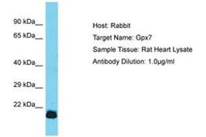 Image no. 1 for anti-Glutathione Peroxidase 7 (GPX7) (AA 105-154) antibody (ABIN6750347) (Glutathione Peroxidase 7 antibody  (AA 105-154))