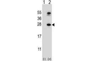 Western blot analysis of DHFR antibody and 293 cell lysate either nontransfected (Lane 1) or transiently transfected (2) with the DHFR gene. (Dihydrofolate Reductase antibody  (AA 135-164))