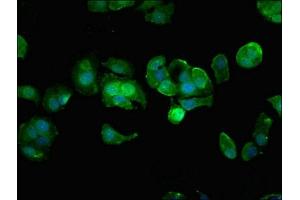 Immunofluorescent analysis of MCF-7 cells using ABIN7155869 at dilution of 1:100 and Alexa Fluor 488-congugated AffiniPure Goat Anti-Rabbit IgG(H+L) (HIPK3 antibody  (AA 841-1130))