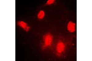 Immunofluorescent analysis of IPPK staining in NIH3T3 cells. (IPPK antibody  (N-Term))