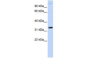 Western Blotting (WB) image for anti-Acidic (Leucine-Rich) Nuclear phosphoprotein 32 Family, Member B (ANP32B) antibody (ABIN2459518)