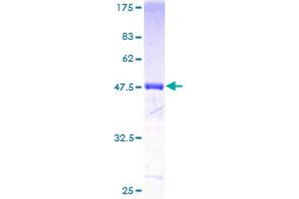 FTH1 Protein (AA 1-183) (GST tag)