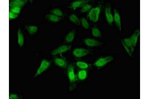 Immunofluorescent analysis of Hela cells using ABIN7148687 at dilution of 1:100 and Alexa Fluor 488-congugated AffiniPure Goat Anti-Rabbit IgG(H+L) (CrkL antibody  (AA 98-303))