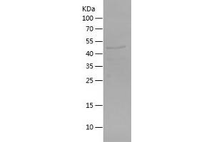 CES2 Protein (AA 356-559) (His-IF2DI Tag)