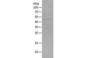 Western Blotting (WB) image for Carboxylesterase 2 (CES2) (AA 356-559) protein (His-IF2DI Tag) (ABIN7282242) (CES2 Protein (AA 356-559) (His-IF2DI Tag))