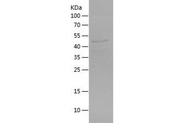 CES2 Protein (AA 356-559) (His-IF2DI Tag)