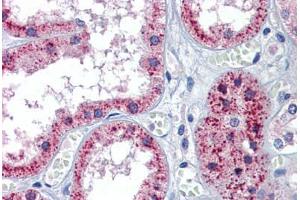 Human Kidney: Formalin-Fixed, Paraffin-Embedded (FFPE) (Patched 1 antibody  (AA 58-107))
