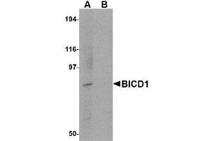 Western blot analysis of BICD1 in Daudi cell lysate with AP30144PU-N BICD1 antibody at 1 μg/ml in (A) the absence and (B) the presence of blocking peptide. (BICD1 antibody  (C-Term))