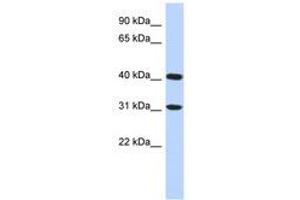 Image no. 1 for anti-Family with Sequence Similarity 46, Member D (FAM46D) (C-Term) antibody (ABIN6741221) (FAM46D antibody  (C-Term))