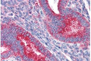 Human Uterus: Formalin-Fixed, Paraffin-Embedded (FFPE) (MVP antibody  (AA 1-894))