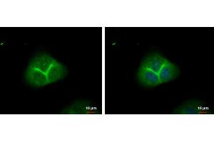 ICC/IF Image alpha Adducin antibody detects alpha Adducin protein at membrane by immunofluorescent analysis. (alpha Adducin antibody)