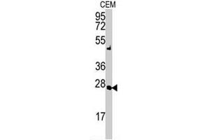 Western blot analysis of AK2 polyclonal antibody  in CEM cell lysate (35 ug/lane). (Adenylate Kinase 2 antibody  (N-Term))