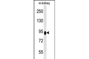 ZBTB41 Antibody (Center) (ABIN654501 and ABIN2844232) western blot analysis in mouse kidney tissue lysates (35 μg/lane). (ZBTB41 antibody  (AA 263-292))