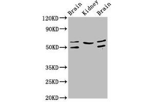 Western Blot Positive WB detected in: Rat brain tissue, Rat kidney tissue, Mouse brain tissue All lanes: ANGPT2 antibody at 3. (Angiopoietin 2 antibody  (AA 19-485))