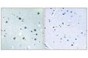 Immunohistochemistry analysis of paraffin-embedded human brain tissue using MYO1D antibody. (Myosin ID antibody)