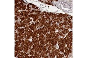 Immunohistochemical staining of human pancreas with HARBI1 polyclonal antibody  shows strong cytoplasmic positivity in exocrine glandular cells at 1:500-1:1000 dilution. (HARBI1 antibody)