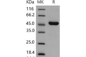 Western Blotting (WB) image for Advanced Glycosylation End Product-Specific Receptor (AGER) (Active) protein (His tag) (ABIN7320260) (RAGE Protein (His tag))